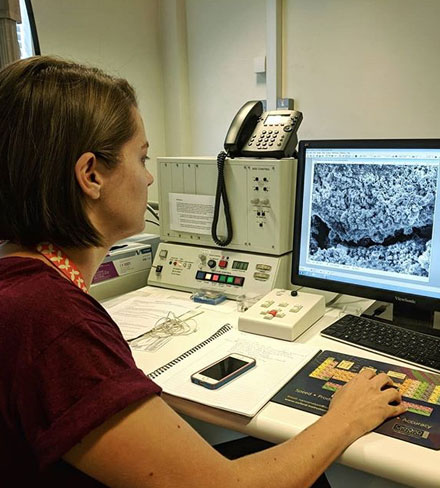 Roche conducts SEM (scanning electron microscope) analysis